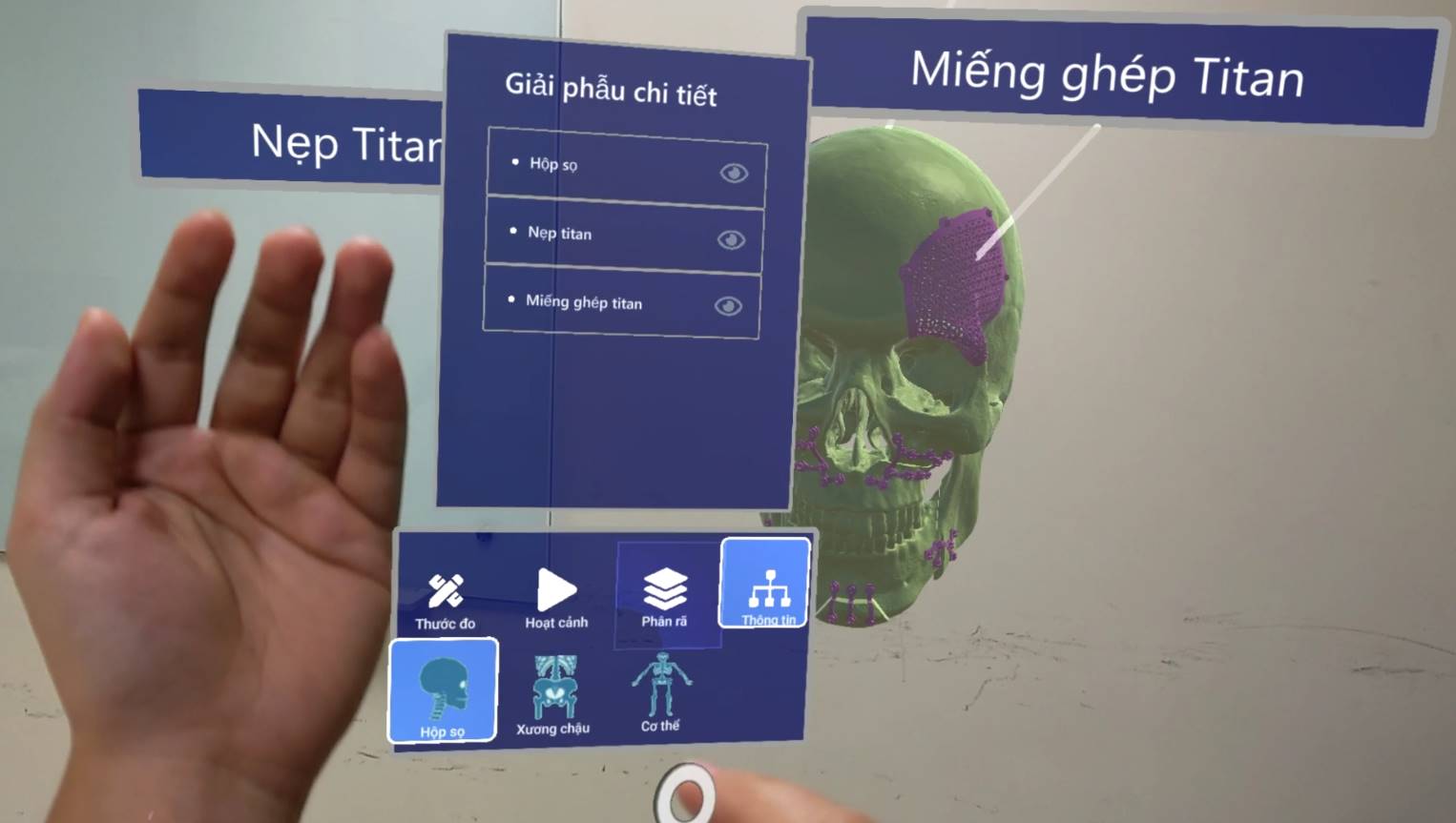 XR giúp tái hiện mô hình hộp sọ và phương án phẫu thuật cấy ghép cho bệnh nhân
